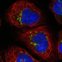 UGT Antibody, Novus Biologicals 25ul | Buy Online | Novus Biologicals | Fisher Scientific